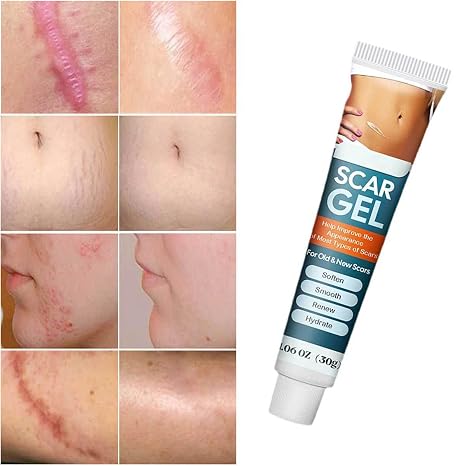 Silicone Scar Removal Gel - Skincare Treatment Designed For Scar Care