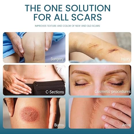 Silicone Scar Removal Gel - Skincare Treatment Designed For Scar Care